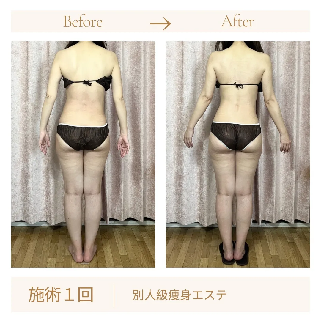 施術1回で、この変化。