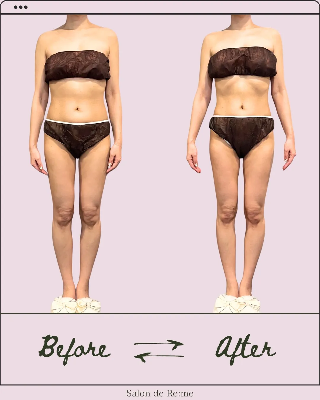 たった1回で、ラインはこんなに変わる。