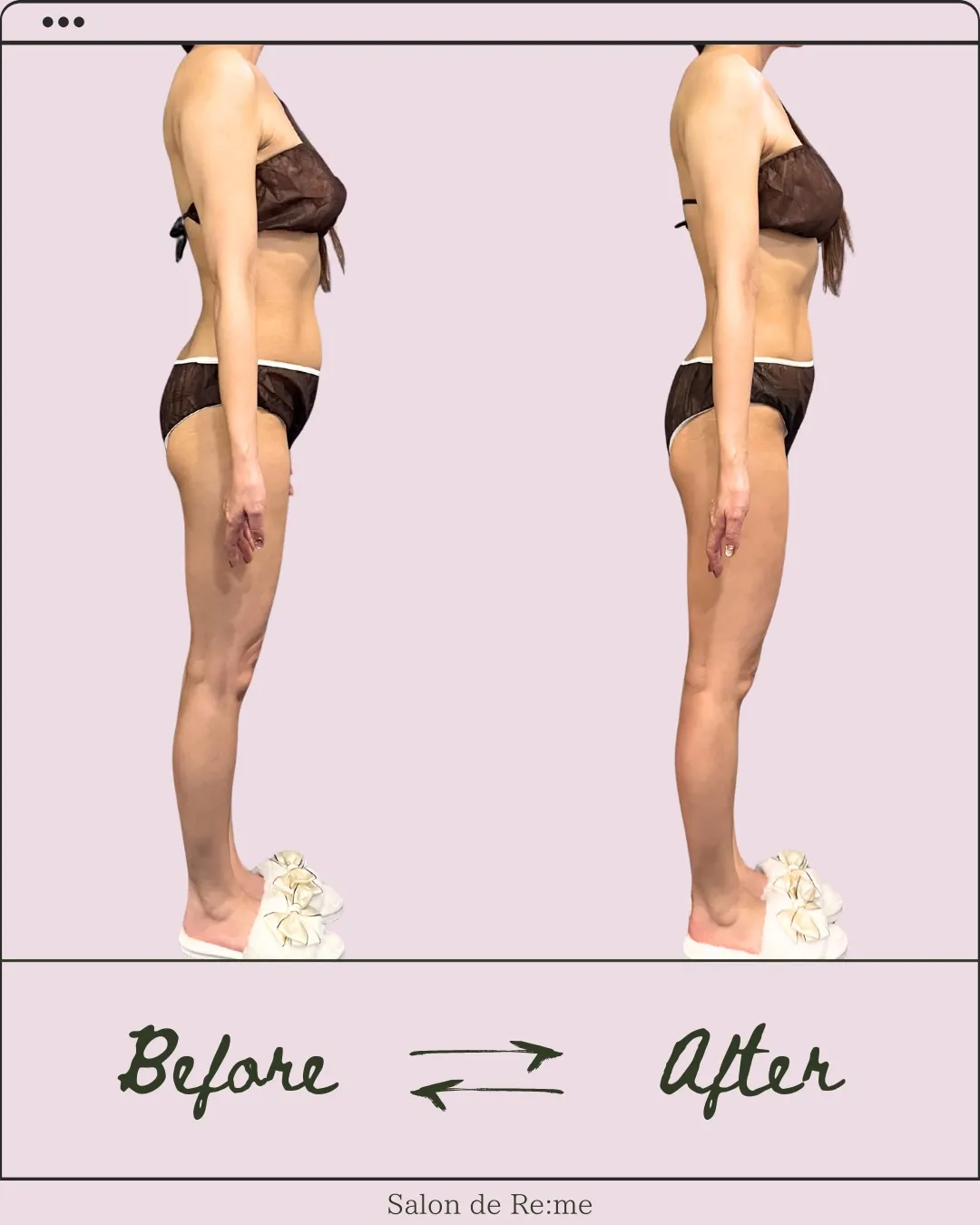 たった1回で、ラインはこんなに変わる。