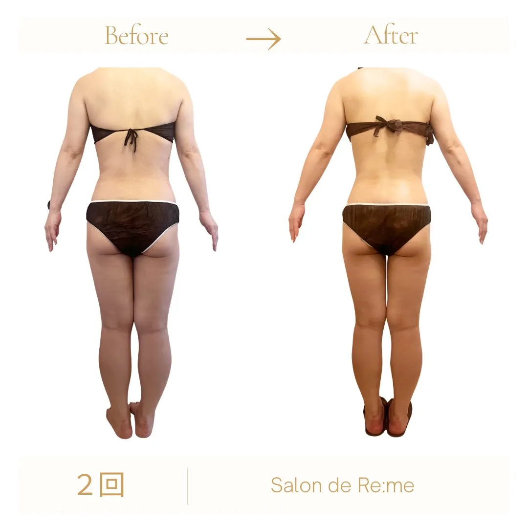「痩せた？」と聞かれるのは、体重ではなく”シルエット”が変わ...